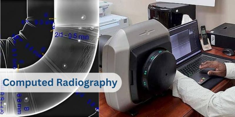Computed Radiography