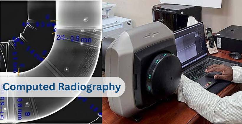 Computed Radiography